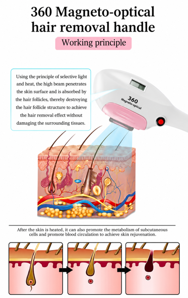 4-in-1 Clinical IPL Laser Machine with Nd:YAG, Pico & RF